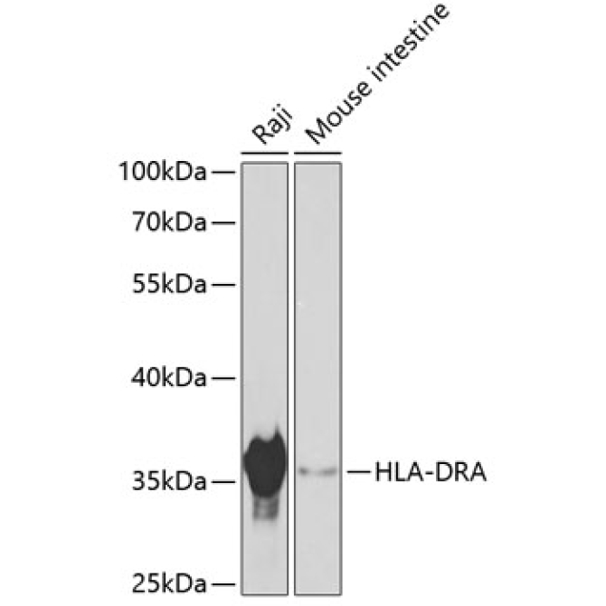 HLA-DRA Rabbit Polyclonal Antibody