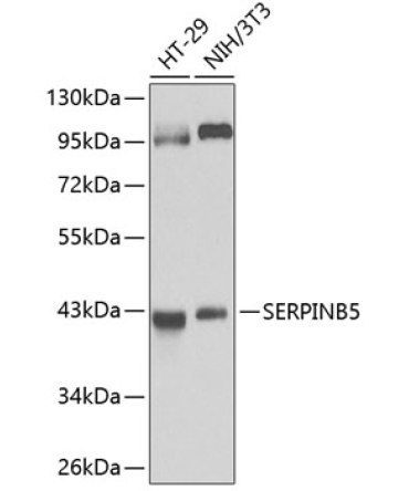 SERPINB5 Rabbit Polyclonal Antibody [KO Validated]
