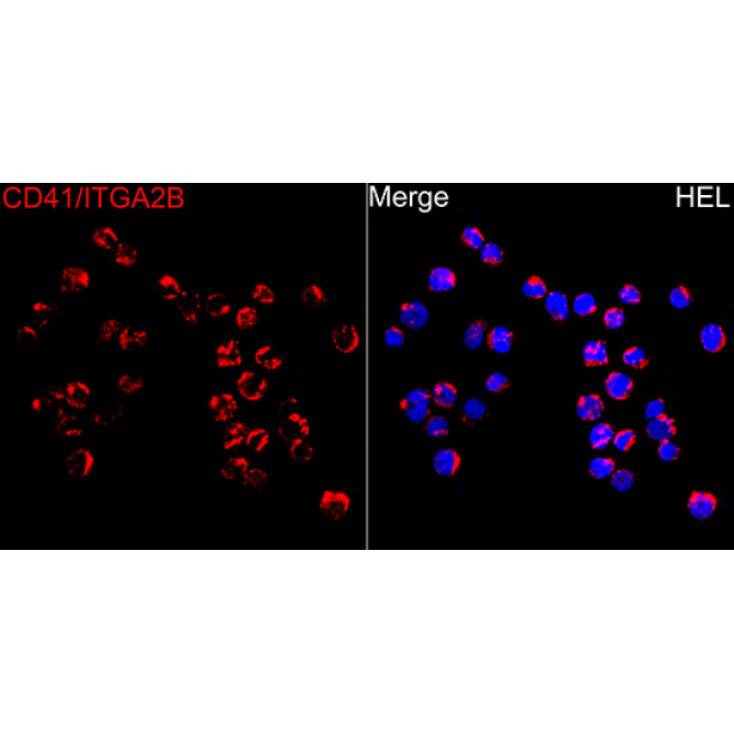 CD41/ITGA2B Rabbit Polyclonal Antibody