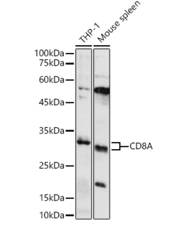 CD8A Rabbit Polyclonal Antibody
