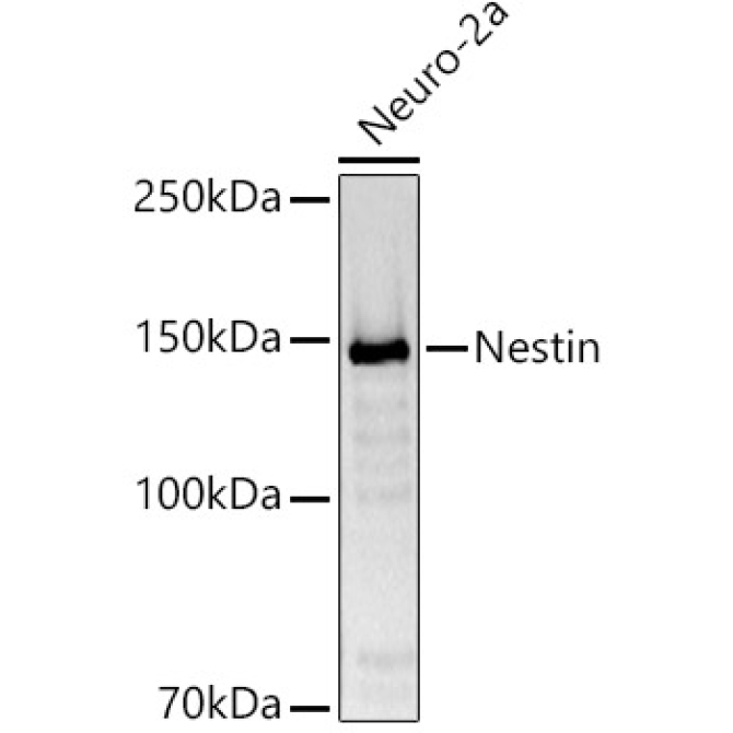 Nestin Rabbit Polyclonal Antibody