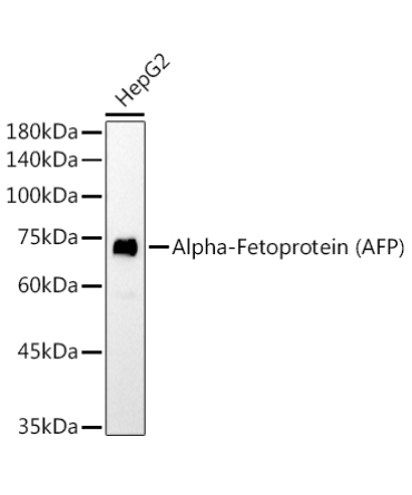Alpha-Fetoprotein (AFP) Mouse Monoclonal Antibody