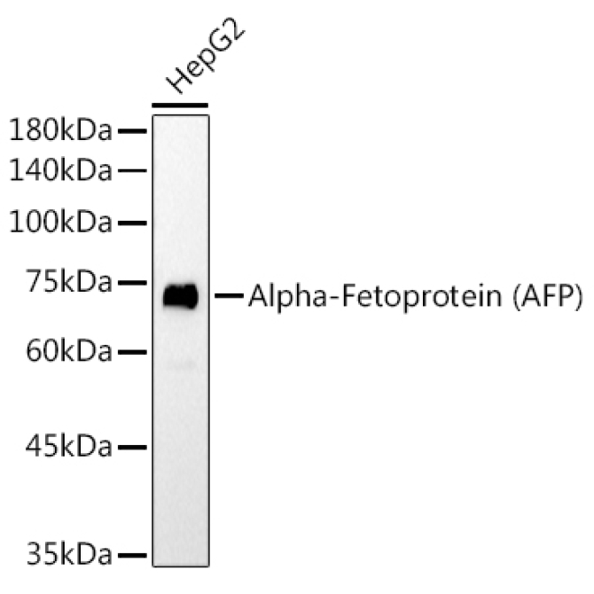 Alpha-Fetoprotein (AFP) Mouse Monoclonal Antibody