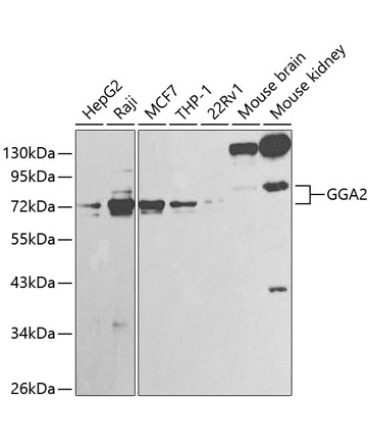 GGA2 Rabbit Polyclonal Antibody