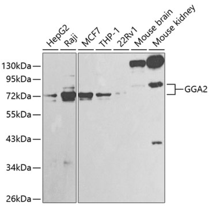 GGA2 Rabbit Polyclonal Antibody