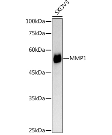 MMP1 Rabbit Polyclonal Antibody
