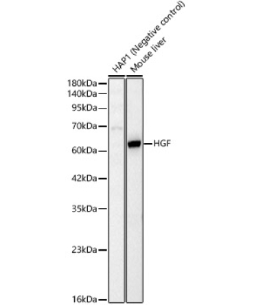 HGF Rabbit Polyclonal Antibody