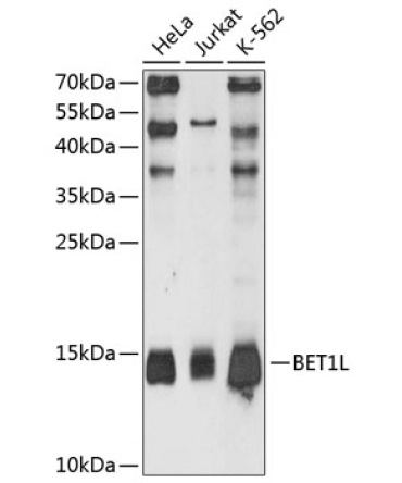 BET1L Rabbit Polyclonal Antibody