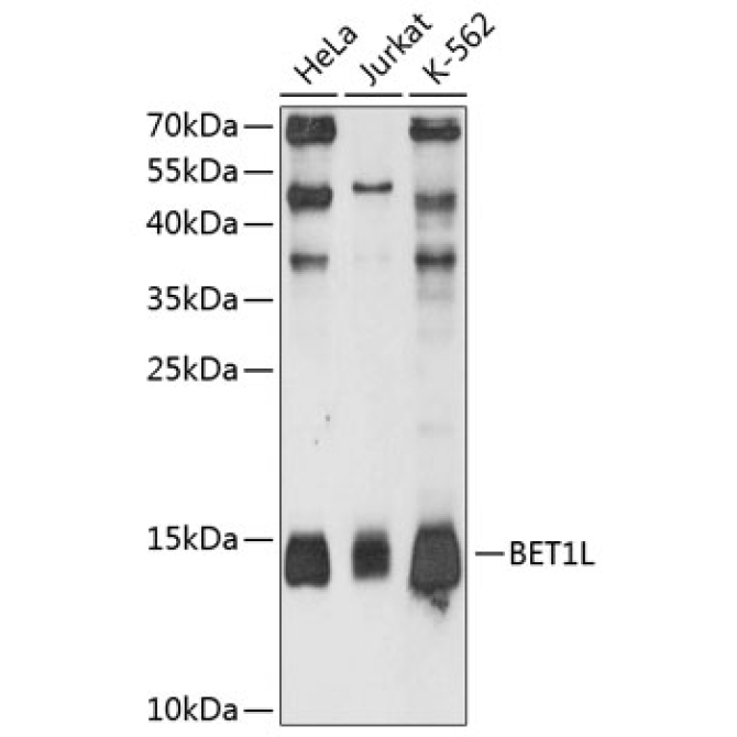 BET1L Rabbit Polyclonal Antibody