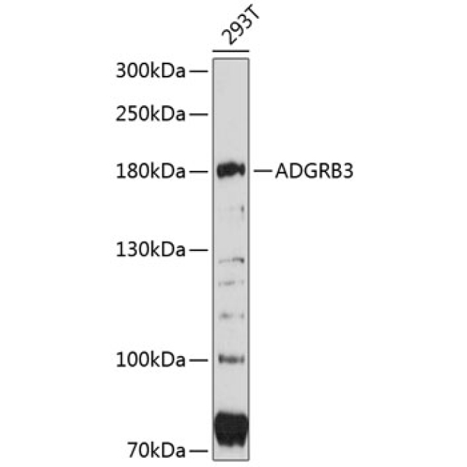 ADGRB3 Rabbit Polyclonal Antibody