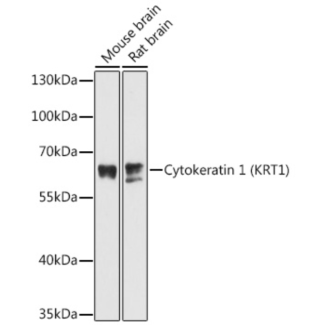 Cytokeratin 1 (KRT1) Rabbit Polyclonal Antibody