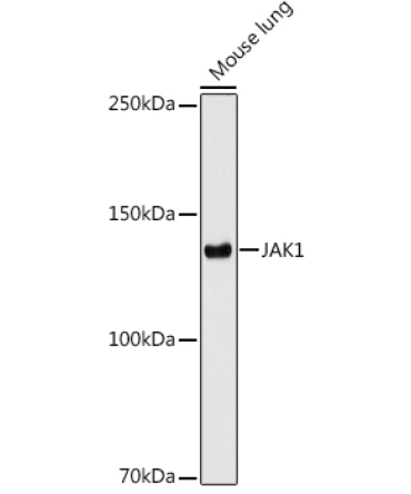 JAK1 Rabbit Monoclonal Antibody