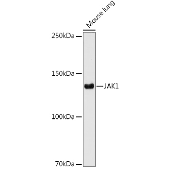 JAK1 Rabbit Monoclonal Antibody
