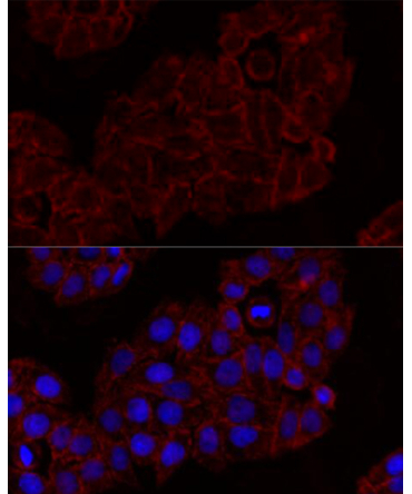 KLRK1 Rabbit Polyclonal Antibody