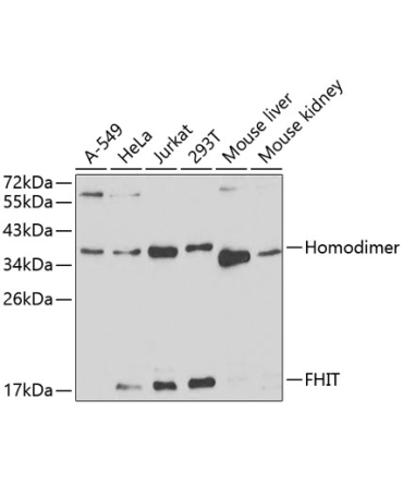 FHIT Rabbit Polyclonal Antibody