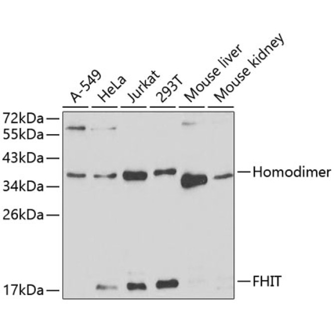 FHIT Rabbit Polyclonal Antibody
