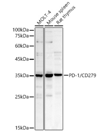 PD-1/CD279 Rabbit Polyclonal Antibody