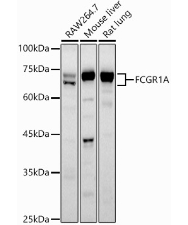 CD64 Rabbit Polyclonal Antibody