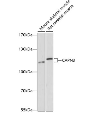 CAPN3 Rabbit Polyclonal Antibody