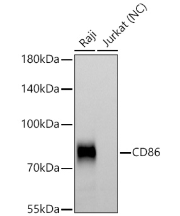 CD86 Rabbit Polyclonal Antibody