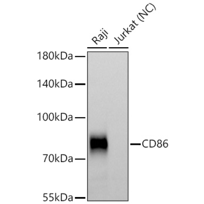 CD86 Rabbit Polyclonal Antibody