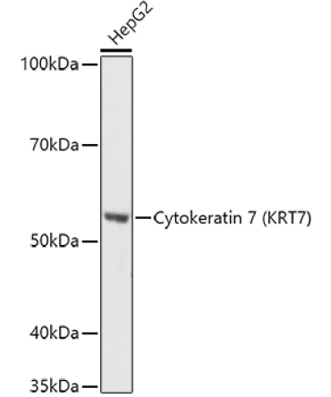 Cytokeratin 7 (KRT7) Rabbit Polyclonal Antibody