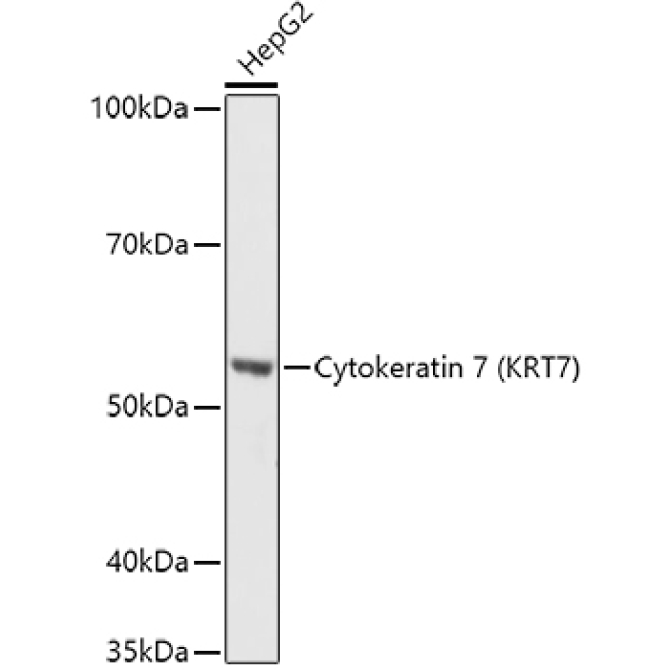 Cytokeratin 7 (KRT7) Rabbit Polyclonal Antibody