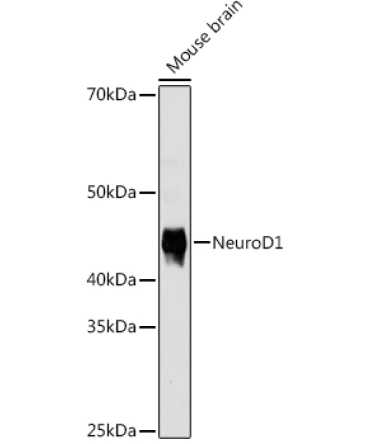 NeuroD1 Rabbit Monoclonal Antibody