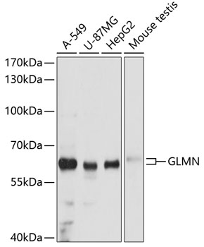 GLMN Rabbit Polyclonal Antibody