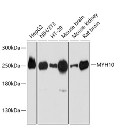 MYH10 Rabbit Polyclonal Antibody