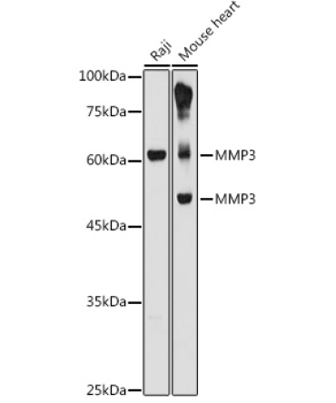 MMP3 Rabbit Polyclonal Antibody