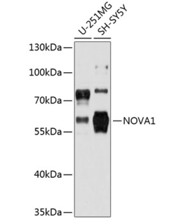 NOVA1 Rabbit Polyclonal Antibody
