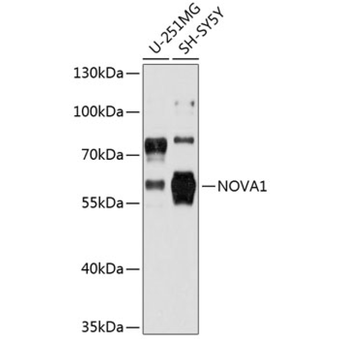 NOVA1 Rabbit Polyclonal Antibody