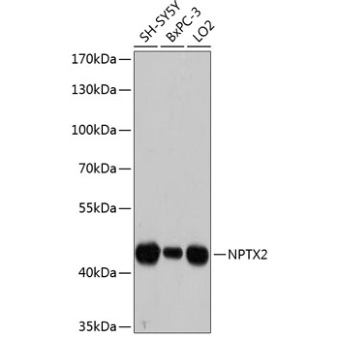 NPTX2 Rabbit Polyclonal Antibody