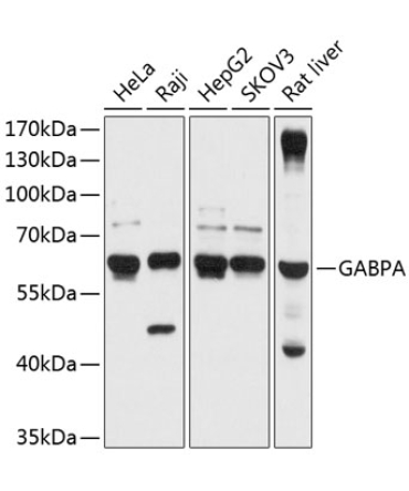 GABPA Rabbit Polyclonal Antibody
