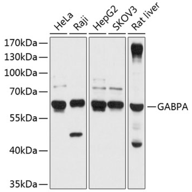 GABPA Rabbit Polyclonal Antibody