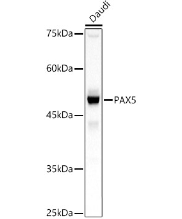 PAX5 Rabbit Polyclonal Antibody