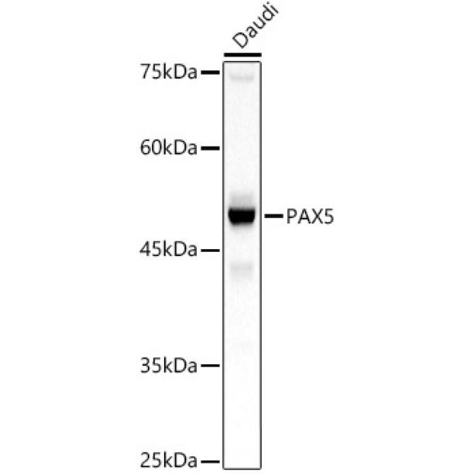 PAX5 Rabbit Polyclonal Antibody