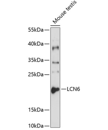 LCN6 Rabbit Polyclonal Antibody