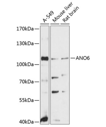 ANO6 Rabbit Polyclonal Antibody