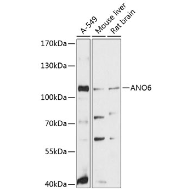 ANO6 Rabbit Polyclonal Antibody