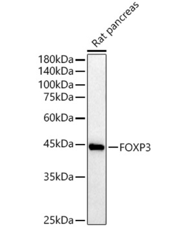FOXP3 Rabbit Polyclonal Antibody