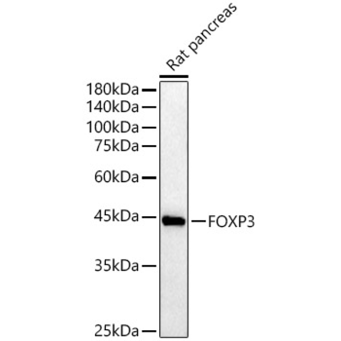 FOXP3 Rabbit Polyclonal Antibody