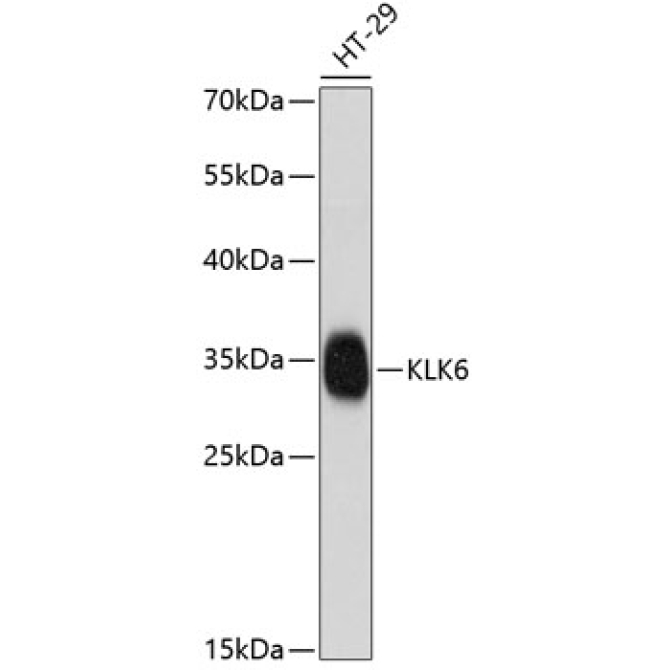 KLK6 Rabbit Polyclonal Antibody