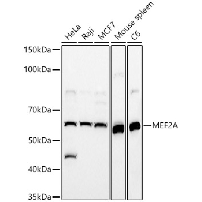 MEF2A Rabbit Polyclonal Antibody