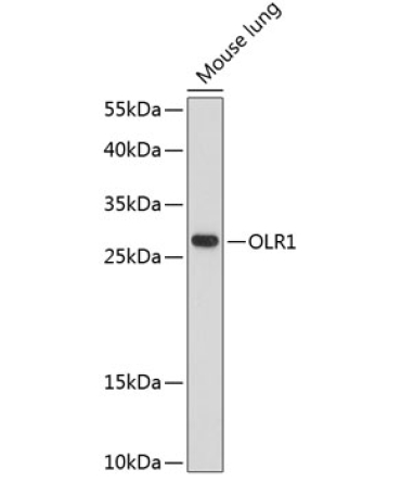 OLR1 Rabbit Polyclonal Antibody