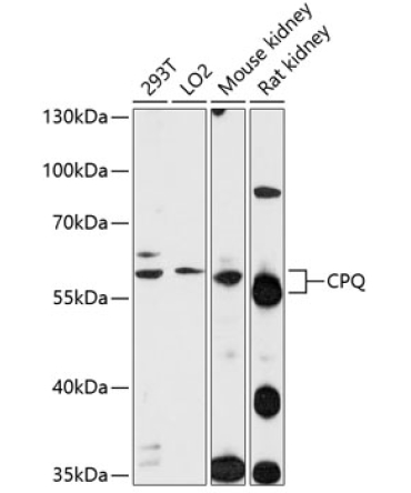 CPQ Rabbit Polyclonal Antibody