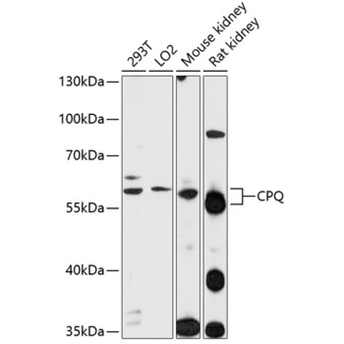 CPQ Rabbit Polyclonal Antibody