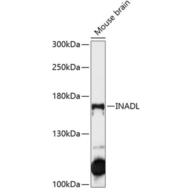 INADL Rabbit Polyclonal Antibody