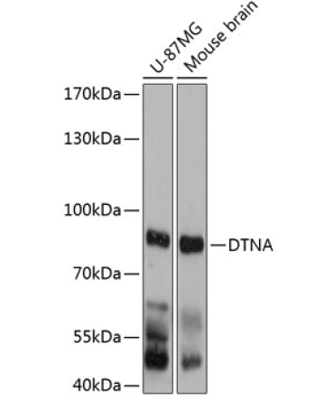 DTNA Rabbit Polyclonal Antibody